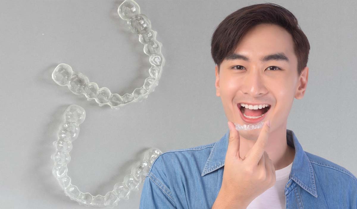 Invisalign